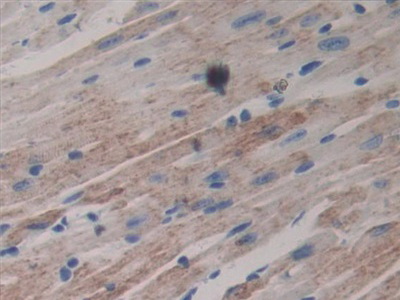 Polyclonal Antibody to Laminin Beta 3 (LAMb3)