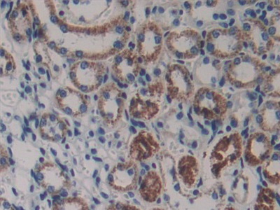 Polyclonal Antibody to Laminin Beta 3 (LAMb3)