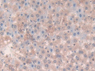 Polyclonal Antibody to Laminin Beta 3 (LAMb3)