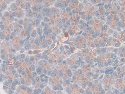 Polyclonal Antibody to Laminin Beta 3 (LAMb3)