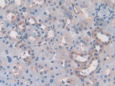 Polyclonal Antibody to Laminin Beta 3 (LAMb3)