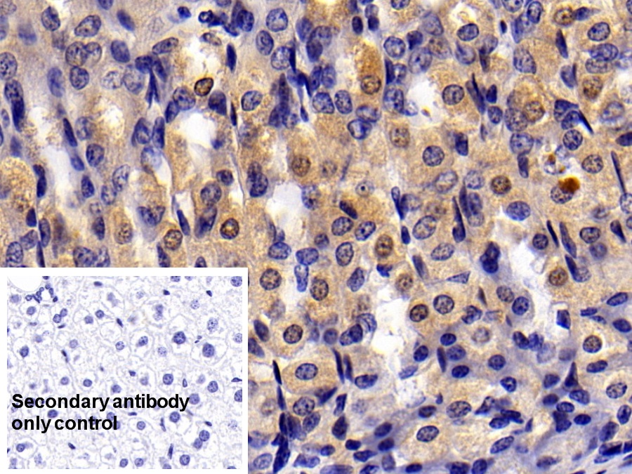 Polyclonal Antibody to Laminin Gamma 1 (LAMC1)