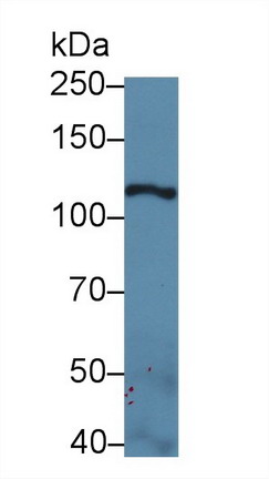 Polyclonal Antibody to Laminin Gamma 2 (LAMC2)