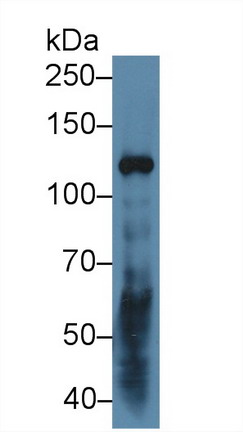 Polyclonal Antibody to Laminin Gamma 2 (LAMC2)