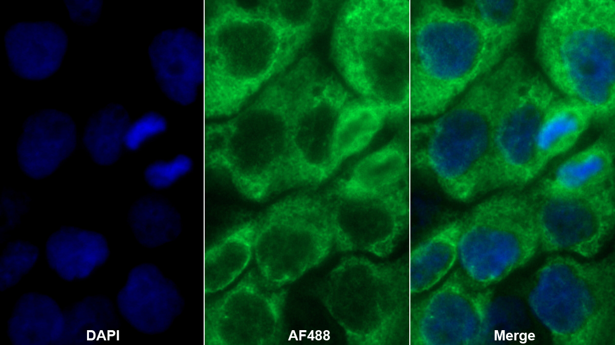 Polyclonal Antibody to Laminin Gamma 2 (LAMC2)