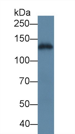 Polyclonal Antibody to Laminin Gamma 2 (LAMC2)