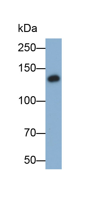 Polyclonal Antibody to Laminin Gamma 2 (LAMC2)