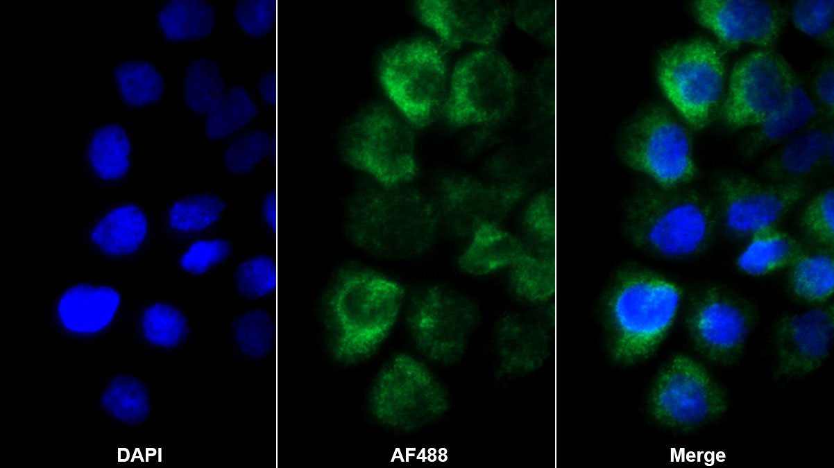 Polyclonal Antibody to Laminin Gamma 2 (LAMC2)