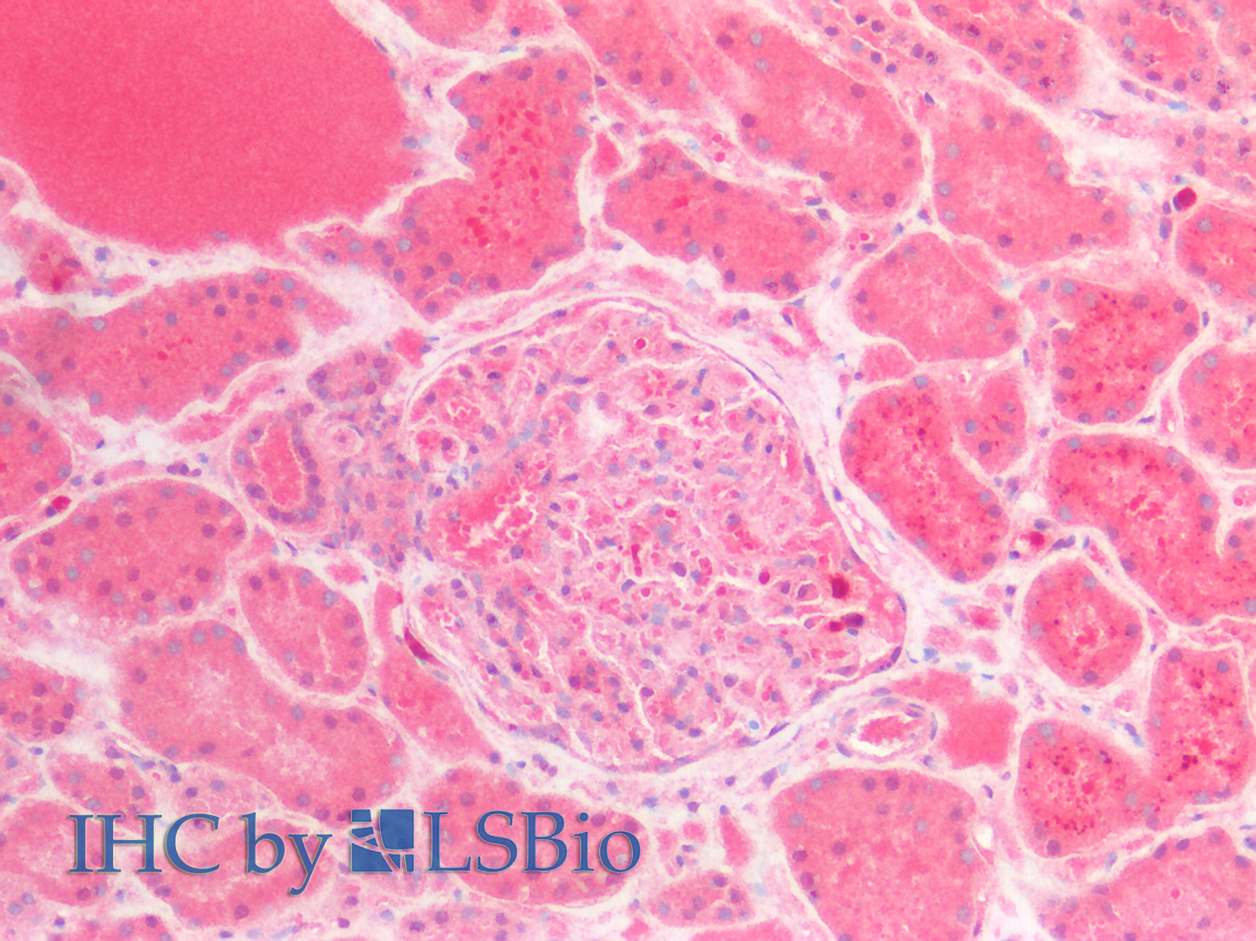 Polyclonal Antibody to Laminin Gamma 3 (LAMC3)