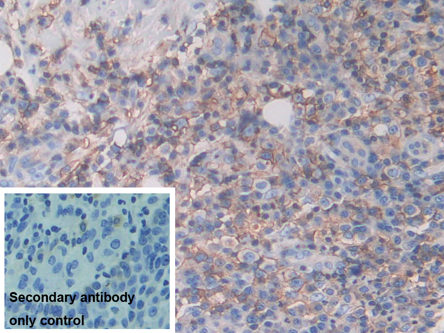 Polyclonal Antibody to Major Histocompatibility Complex Class I C (MHCC)