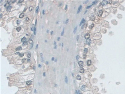 Polyclonal Antibody to Major Histocompatibility Complex Class I B (MHCB)