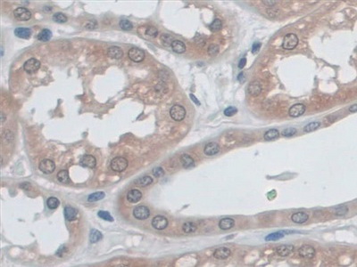 Polyclonal Antibody to Major Histocompatibility Complex Class I B (MHCB)