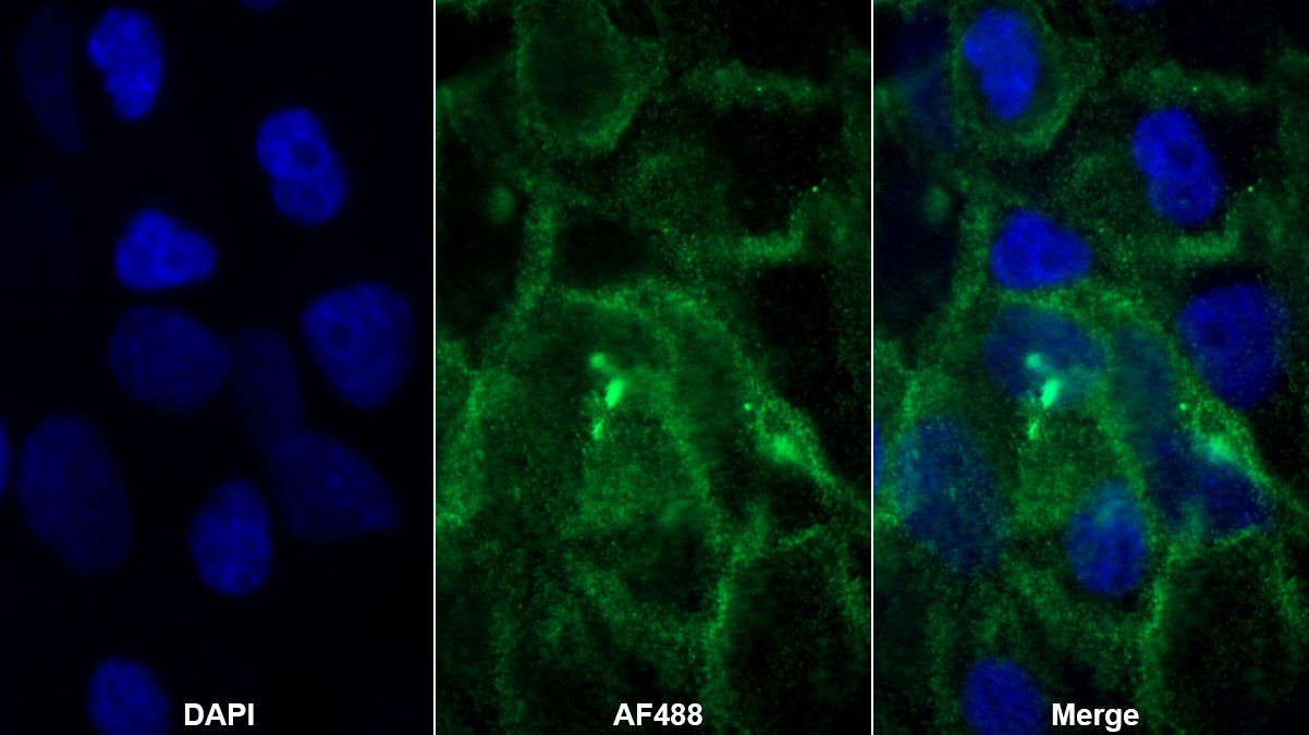 Polyclonal Antibody to Major Histocompatibility Complex Class I B (MHCB)