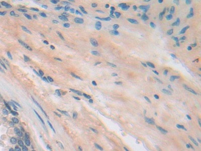 Polyclonal Antibody to Integrin Beta 5 (ITGb5)