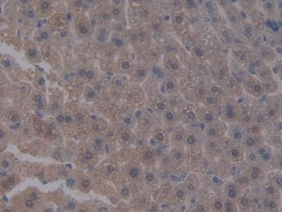 Polyclonal Antibody to Integrin Beta 5 (ITGb5)