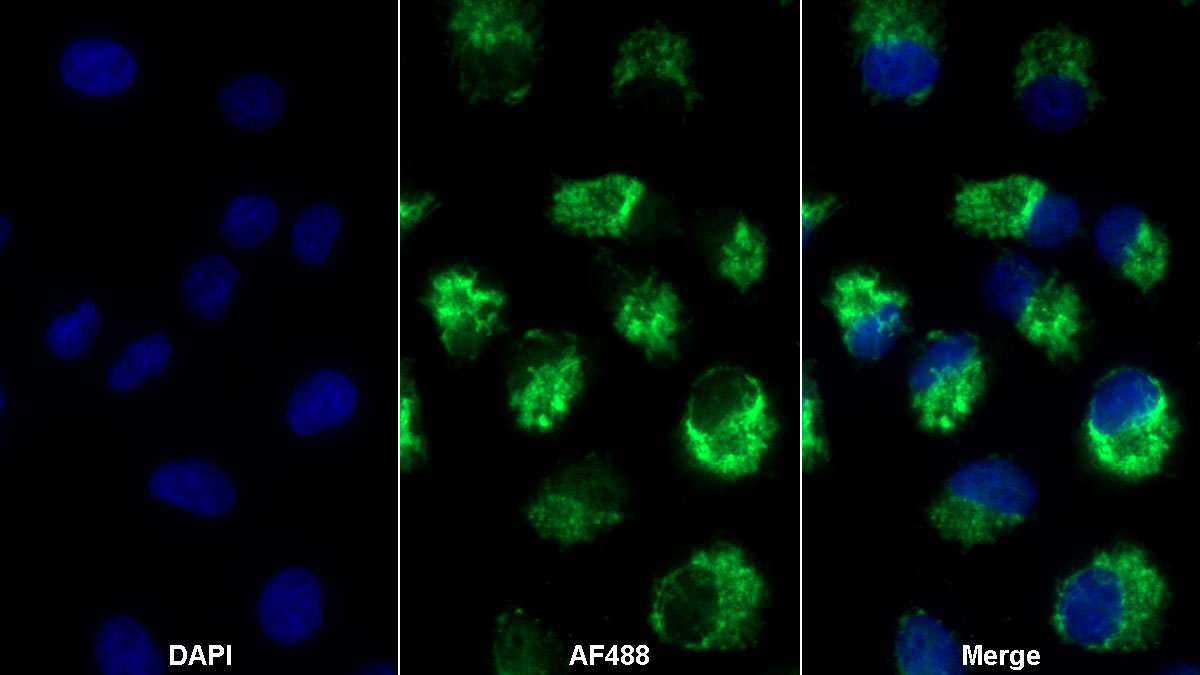 Polyclonal Antibody to Integrin Beta 6 (ITGb6)