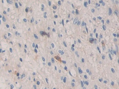 Polyclonal Antibody to Bone Morphogenetic Protein 15 (BMP15)