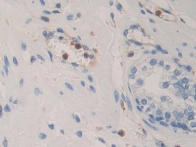 Polyclonal Antibody to Bone Morphogenetic Protein 15 (BMP15)