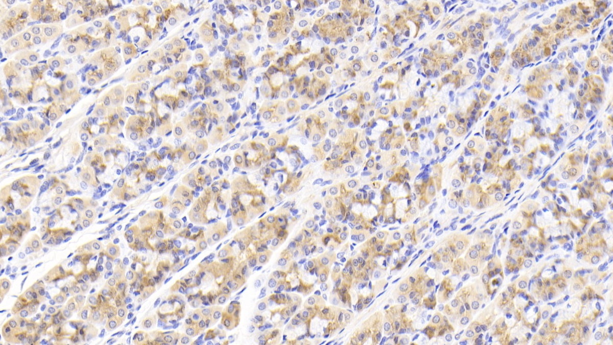 Polyclonal Antibody to Growth Differentiation Factor 5 (GDF5)