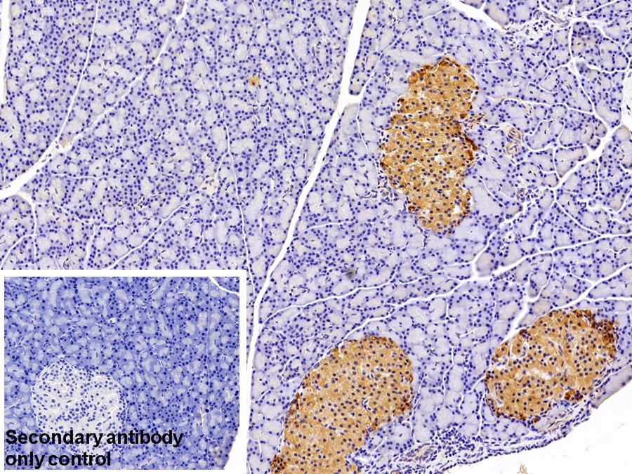 Polyclonal Antibody to Growth Differentiation Factor 5 (GDF5)