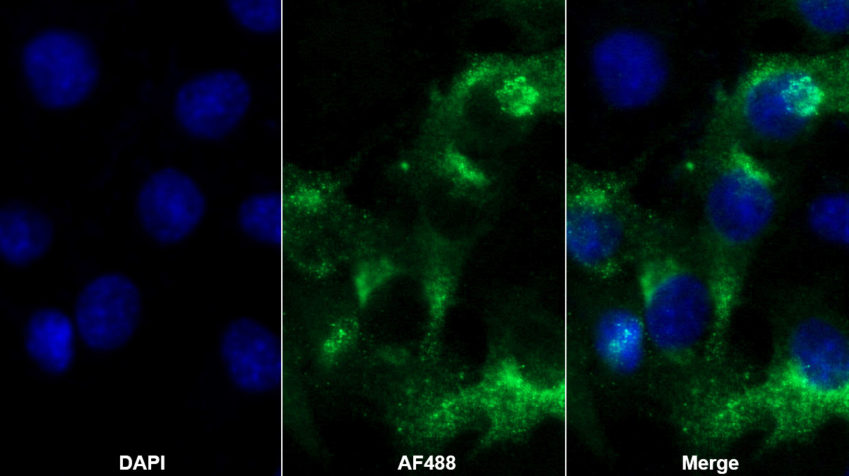 Polyclonal Antibody to Activin A Receptor Type I B (ACVR1B)