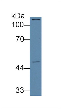 Polyclonal Antibody to Activin A Receptor Type I C (ACVR1C)