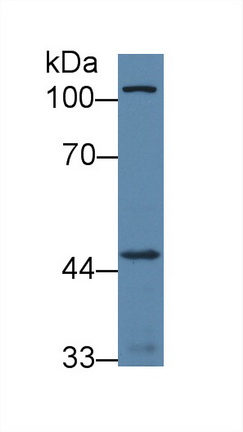 Polyclonal Antibody to Activin A Receptor Type I C (ACVR1C)