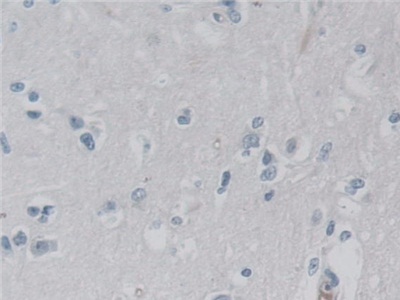 Polyclonal Antibody to Activin A Receptor Type I C (ACVR1C)