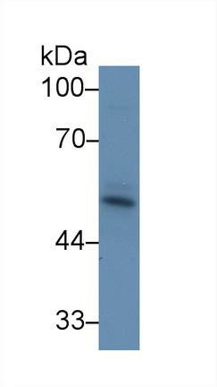 Polyclonal Antibody to Activin A Receptor Type II A (ACVR2A)