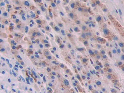 Polyclonal Antibody to Activin A Receptor Type II A (ACVR2A)