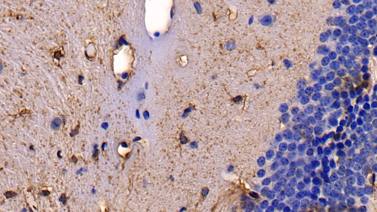 Polyclonal Antibody to Activin A Receptor Type II A (ACVR2A)