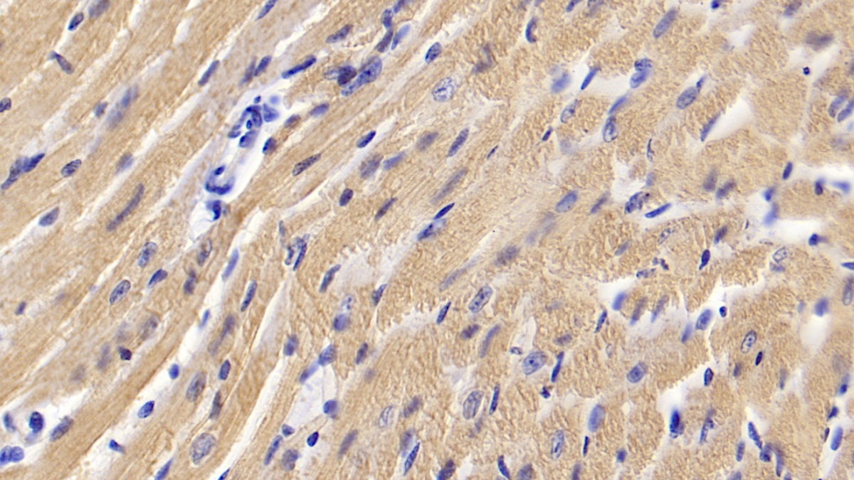 Polyclonal Antibody to Activin A Receptor Type II A (ACVR2A)