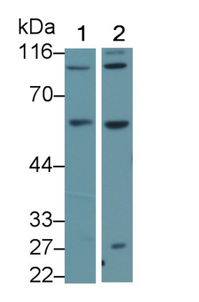 Polyclonal Antibody to Activin A Receptor Type II A (ACVR2A)