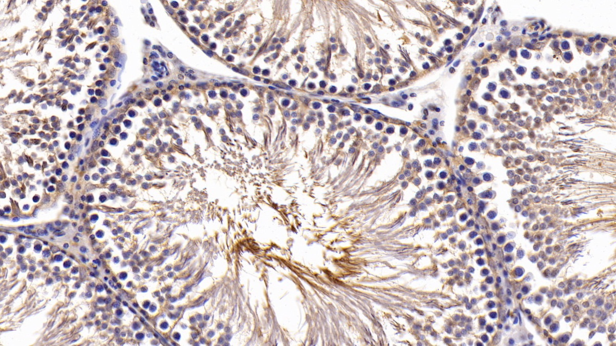 Polyclonal Antibody to Activin A Receptor Type II B (ACVR2B)