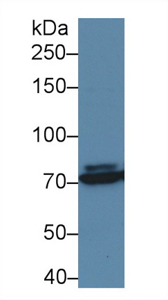 Polyclonal Antibody to Transforming Growth Factor Beta Receptor III (TGFbR3)