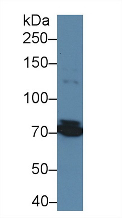 Polyclonal Antibody to Transforming Growth Factor Beta Receptor III (TGFbR3)