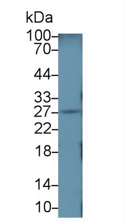 Polyclonal Antibody to SMAD family member 6 (SMAD6)