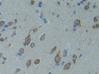 Polyclonal Antibody to SMAD family member 9 (SMAD9)