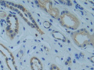 Polyclonal Antibody to SMAD family member 9 (SMAD9)