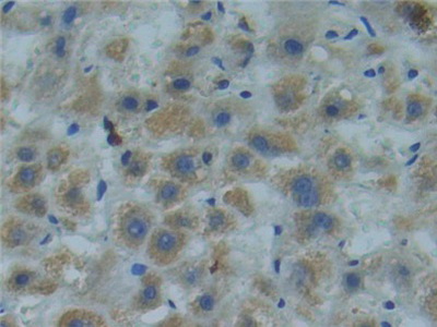 Polyclonal Antibody to SMAD family member 9 (SMAD9)