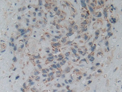 Polyclonal Antibody to SMAD family member 5 (SMAD5)