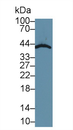 Polyclonal Antibody to SMAD family member 3 (SMAD3)