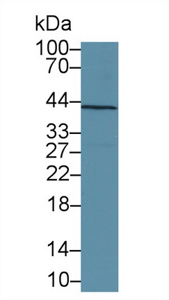 Polyclonal Antibody to SMAD family member 3 (SMAD3)