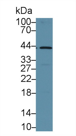 Polyclonal Antibody to SMAD family member 3 (SMAD3)