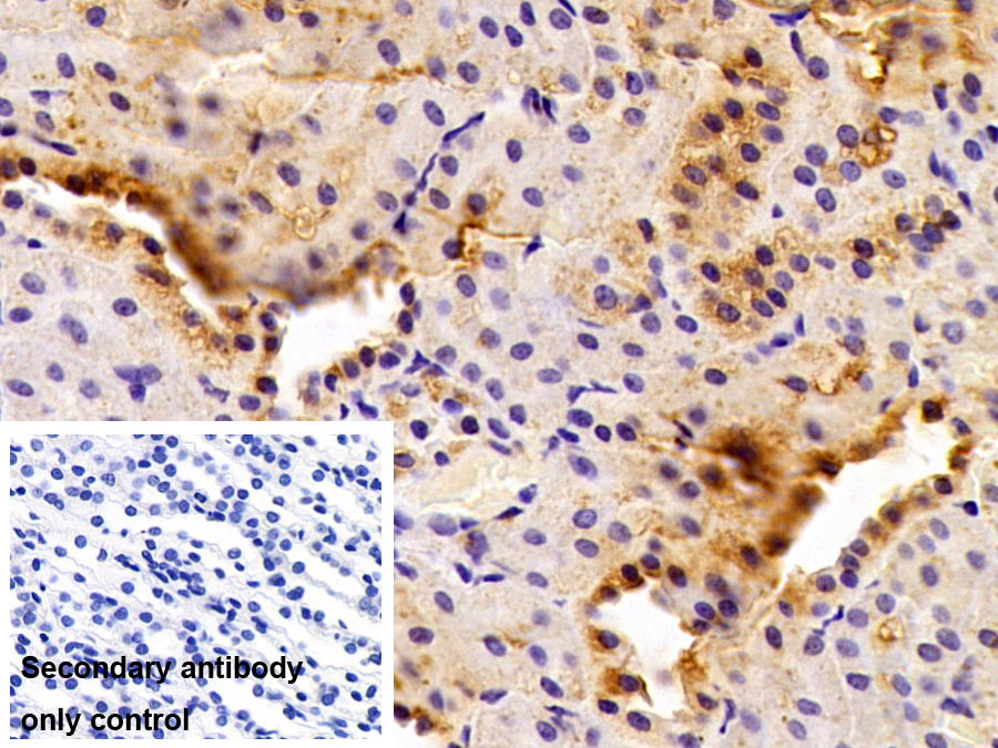 Polyclonal Antibody to SMAD family member 3 (SMAD3)