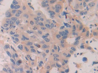 Polyclonal Antibody to Chordin (CHRD)