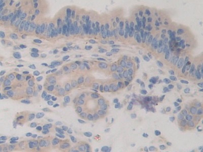 Polyclonal Antibody to Chordin (CHRD)