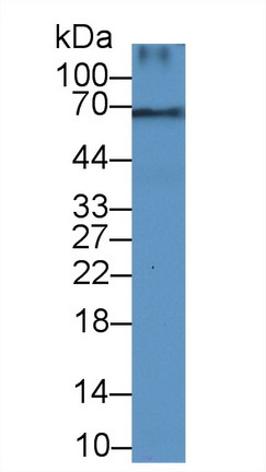 Polyclonal Antibody to Decorin (DCN)