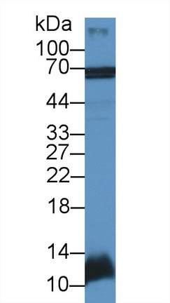 Polyclonal Antibody to Decorin (DCN)