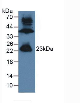 Polyclonal Antibody to Gremlin 1 (GREM1)